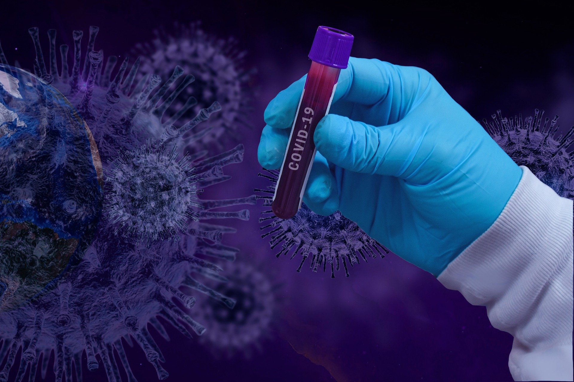 10 novih slučajeva koronavirusa u PGŽ u posljednja 24 sata!