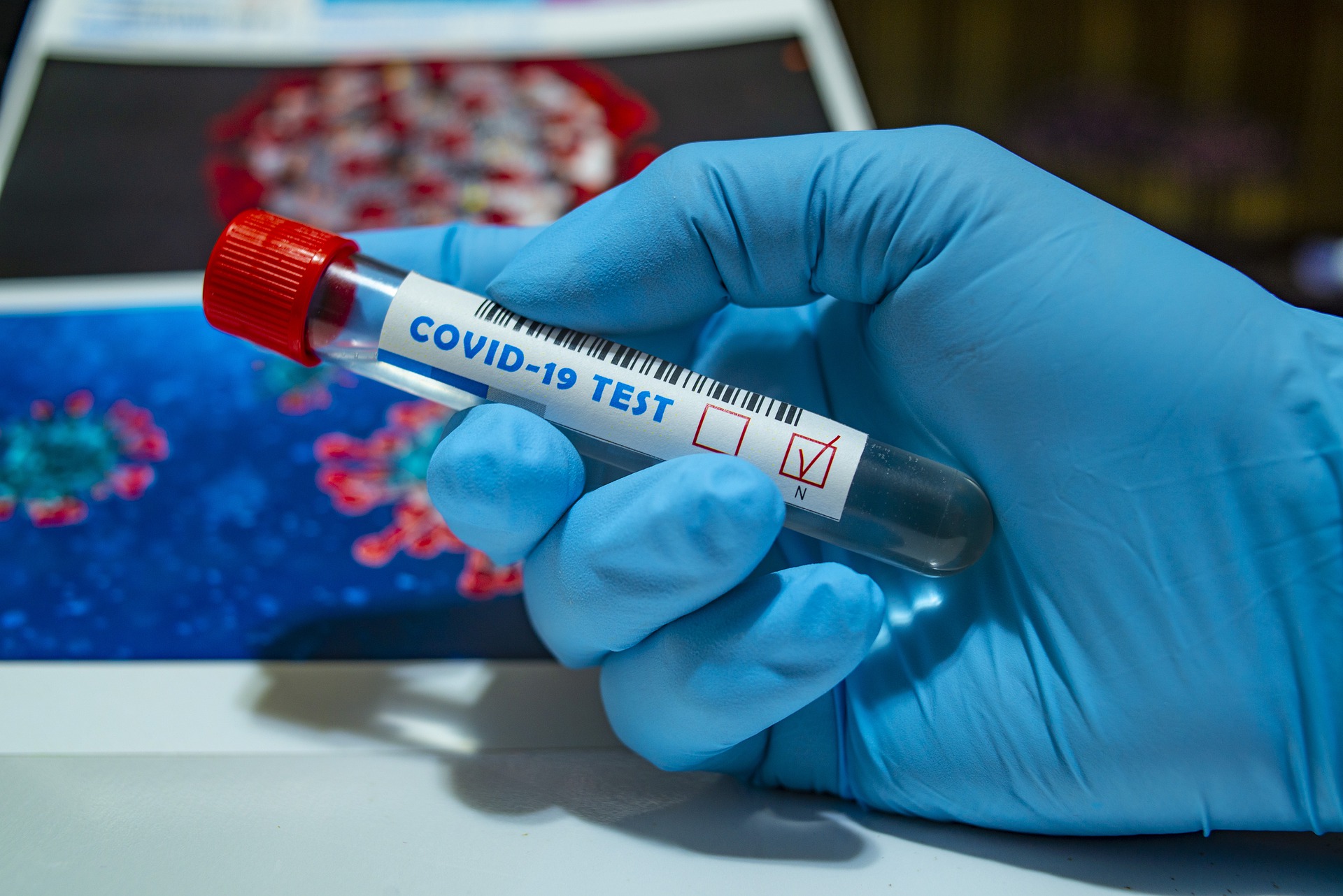 U PGŽ i dalje pada broj aktivnih slučajeva koronavirusa 