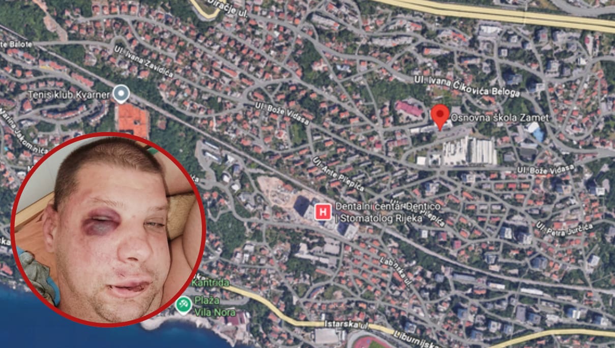 Napad na Zametu: Tko je pretukao mladića s invaliditetom?